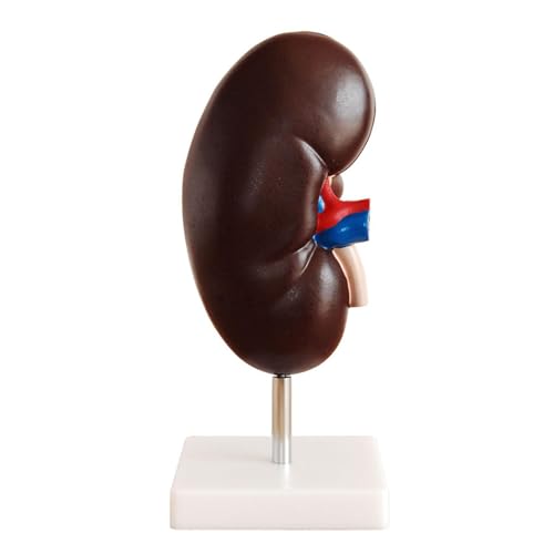 1 Stück 2-Fach vergrößerte menschliche Niere mit Nebennieren anatomisches medizinisches Modell von Huhpa