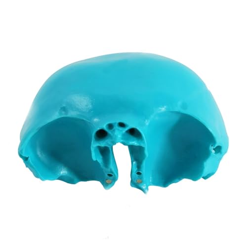 1 Stück menschliche Halswirbel mit Halsschlagader, hinterer Hinterhauptsbandscheibe und neuroorthopädischem Modell von Huhpa