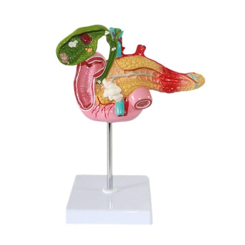 1pc 1:1 Gallenblase Zwölffingerdarm Bauchspeicheldrüse Modell Menschliche Organ Anatomie Modell Medizinische Lehrmittel von Huhpa