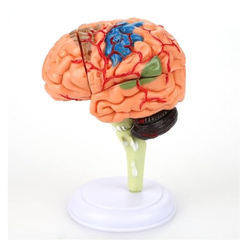 1pc 3D Zerlegte Anatomische Gehirn Modell Von Menschlichen Schule Pädagogisches Anatomie Medizinische Gehirn Modell Anatomisches Lehrmittel von Huhpa