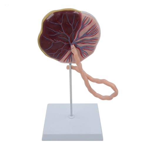 1pc Anatomisches Plazenta Modell Fötus Standseilbahn Anatomie Modell Baby Geburt Modell Medizinische Lehrmittel Lebensgroße Pädagogische Ausrüstung von Huhpa