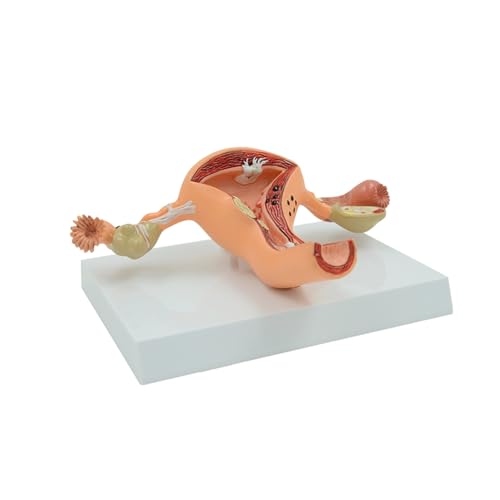 1pc Erkrankte Gebärmutter Modell Eierstock Weibliche Genital Organ Anatomisches Modell Harnsystem Medizinische Lehre Bildungs ​​Ausrüstung von Huhpa