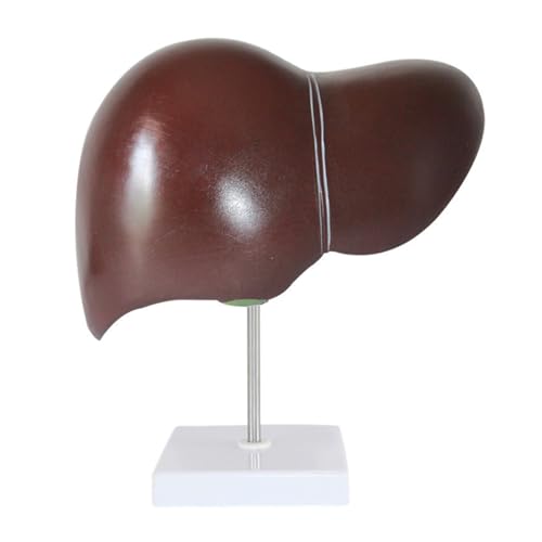 1pc Medizinische Requisiten Modell Menschliche Leber Pathologische Anatomie Modell Anatomie Lehre Display Werkzeug Labor Ausrüstung von Huhpa