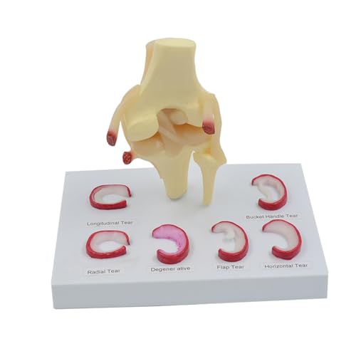 1pc Meniskus Naht Modell Lebensgroße Menschliche Halbmenisken Medizinische Wissenschaft Lehrmittel Anatomisches Modell 1pc Meniskus Naht Modell Lebensgroße Menschliche Halbmenisken Medizinische Wissenschaft Lehrmittel Anatomisches Modell von Huhpa