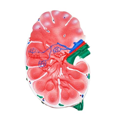 1pc Menschliche Lymphknoten Expansion Modell Abnehmbare Lehre Labor Ausrüstung Medizinische Demonstration Aids von Huhpa