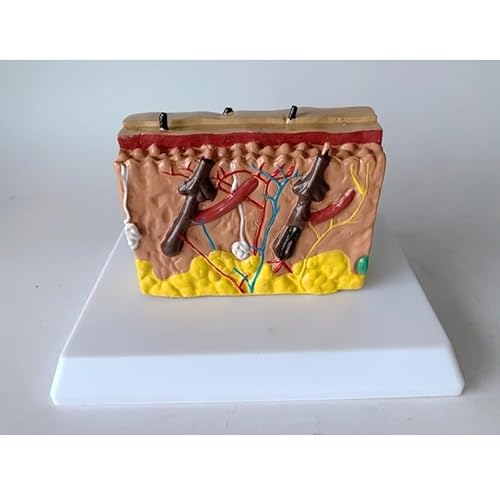 1pc Menschliches Anatomisches Haut Subkutanes Gewebe Akne Epidermis Anatomie Medizinische Modell Schule Krankenhaus Lehre Bildungs ​​Liefert von Huhpa