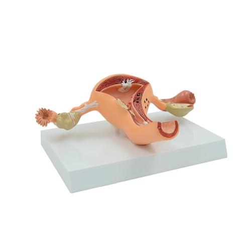 1pc Menschliches Modell Weiblichen Reproduktiven Gebärmutter Vagina Eierstock Gebärmutter Lehre Form Pathologische Veränderungen Wissenschaft Ausbildung Lehrmittel von Huhpa