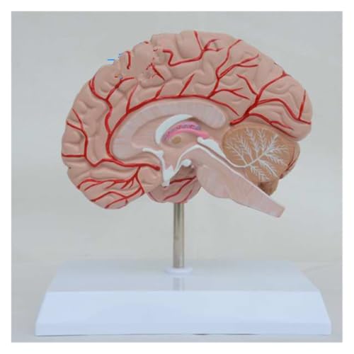 1pc Menschliches Rechtes Gehirn Blutgefäß Medizinische Display Anatomisches Modell Probe Medizinische Wissenschaft Liefert von Huhpa