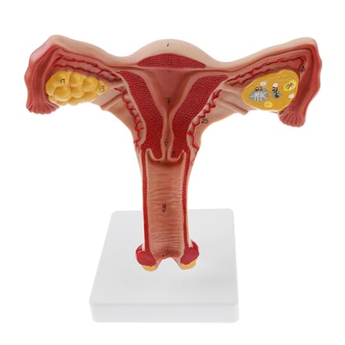 1pc Menschliches Weibliches Uterus Eierstock Eileiter Modell Medizinische Wissenschaft Lehrmittel 1pc Menschliches Weibliches Uterus Eierstock Eileiter Modell Medizinische Wissenschaft Lehrmittel von Huhpa
