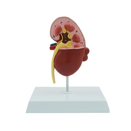 1pc Normal Und Pathologie Niere Anatomisches Modell Erkrankte Niere Harnsystem Orgel Medizinische Geschenk Pädagogische Ausrüstung Lehre von Huhpa