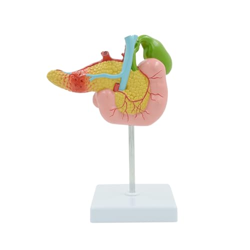 1pc Pathologische Modell Der Bauchspeicheldrüse Zwölffingerdarm Und Gallenblase Menschliches Inneres Organ Anatomisches Modell Lehrmittel Lehre von Huhpa