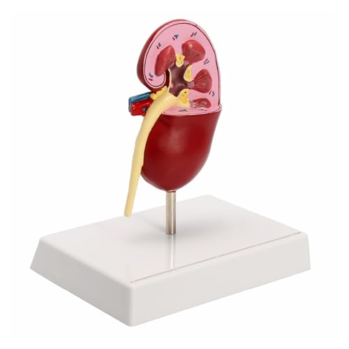 „1set Anatomisches Modell der Niere, 2-seitiges erkranktes Anatomiemodell, Medica L Glomerulus Niere Nephron R Enal Anatomisches Modell“ „1set Anatomisches Modell der Niere, 2-seitiges erkranktes Anatomiemodell, Medica L Glomerulus Niere Nephron R Enal Anatomisches Modell“ von Huhpa