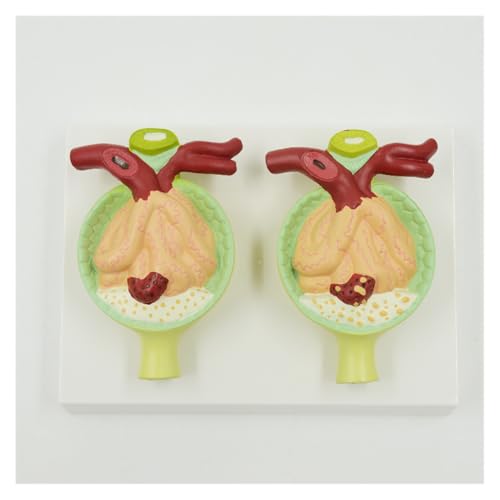 1set Nephron Krankheiten Modell Menschliches Anatomisches Modell Harnsystem Anatomie Medizinische Lehre Bildungs Ausrüstung Wissenschaftliche Studie 1set Nephron Krankheiten Modell Menschliches Anatomisches Modell Harnsystem Anatomie Medizinische Lehre Bildungs Ausrüstung Wissenschaftliche Studie von Huhpa