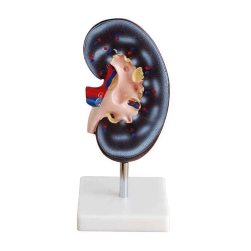 Huhpa 1 Stück 2X lebensgroßes anatomisches medizinisches Modell der rechten Niere des Menschen auf der Basis Huhpa 1 Stück 2X lebensgroßes anatomisches medizinisches Modell der rechten Niere des Menschen auf der Basis von Huhpa