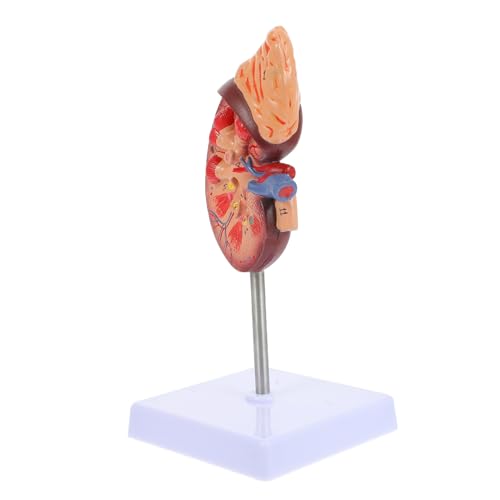 IMIKEYA Nierenmodell Anatomiemodell Biologie Demonstrationsmodell Anatomische Niere Körperteilmodell Organmodell des Menschlichen Körpers Lehrmodell Medizinstudium Schulbildung PVC IMIKEYA Nierenmodell Anatomiemodell Biologie Demonstrationsmodell Anatomische Niere Körperteilmodell Organmodell des Menschlichen Körpers Lehrmodell Medizinstudium Schulbildung PVC von IMIKEYA