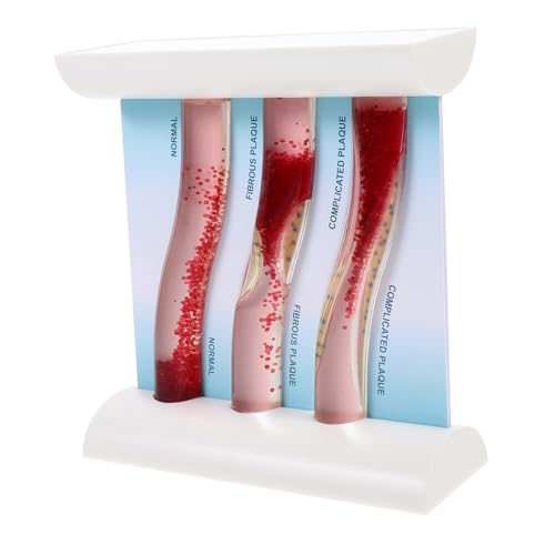 Ipetboom Anatomisches Blutgefäßmodell aus Lehrmaterial zur Simulation von Gefäßerkrankungen und Lipoprotein Schäden für Medizinische Studien und Schulungen von Ipetboom