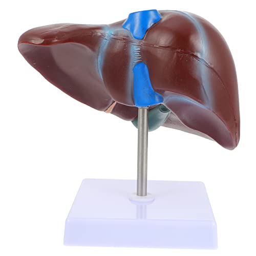 Ipetboom Anatomisches Lebermodell mit Basis Leberanatomiemodell für Medizinische Ausbildung Langlebig und Praktisch zur Anschaulichen Erklärung Leberstruktur Ipetboom Anatomisches Lebermodell mit Basis Leberanatomiemodell für Medizinische Ausbildung Langlebig und Praktisch zur Anschaulichen Erklärung Leberstruktur von Ipetboom