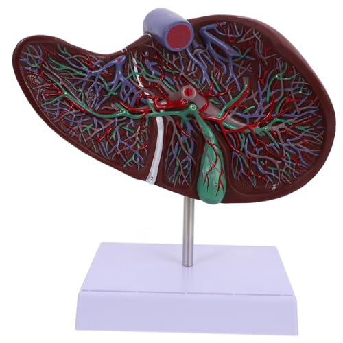Ipetboom Anatomisches Menschliches Lebermodell aus Kunststoff mit Basis Detailliertes Medizinisches Lehrmodell für Ärzte Studenten und um Leberstruktur Anschaulich zu Zeigen Ipetboom Anatomisches Menschliches Lebermodell aus Kunststoff mit Basis Detailliertes Medizinisches Lehrmodell für Ärzte Studenten und um Leberstruktur Anschaulich zu Zeigen von Ipetboom
