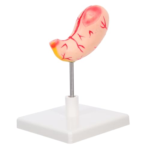 Ipetboom Menschliches Magenmodell Professionelles Magensektionsmodell Für Die Medizinische – Requisite Menschlicher Für Anatomieunterricht Und Demonstration von Ipetboom