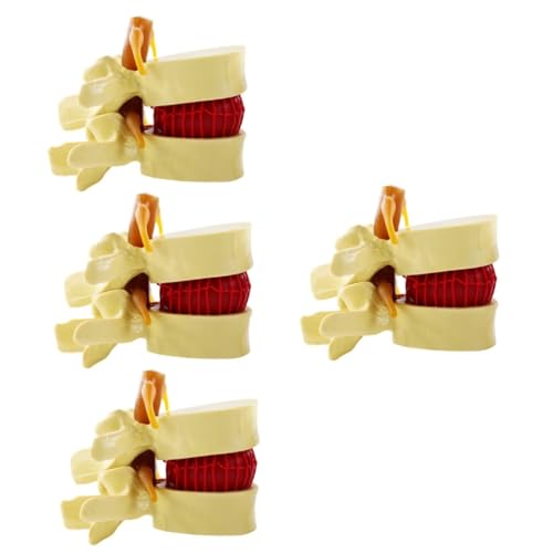 4 Stück Bandscheibenmodell Männchen Körper menschliche Wirbelsäule laborbedarf Wirbelsäulenmodell Modelle Modell der menschlichen Lendenwirbelsäule menschlicher Körper Skelett PVC von JECOMPRIS