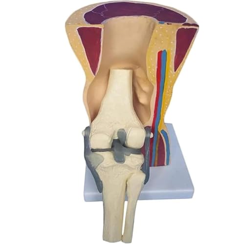 1 Stück menschliches Kniegelenkmodell – anatomisches Lehrmodell for Anwendungen im Gesundheitswesen, Bildung und Ausbildung von JigyHa