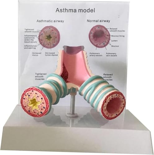 1 Stück Anatomisches Modell der menschlichen Luftröhre – Bronchialmodell des Asthma-Atmungssystems for pädagogische Ausstellungen und Lehrzwecke 1 Stück Anatomisches Modell der menschlichen Luftröhre – Bronchialmodell des Asthma-Atmungssystems for pädagogische Ausstellungen und Lehrzwecke von JingJiangBo