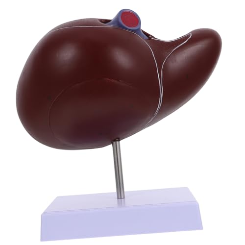 KICHOUSE Anatomisches Lebermodell Lebermodell mit Basis Medizinisches Lehrmodell zur Darstellung Menschlichen Leberstruktur für Medizinische Ausbildung von KICHOUSE