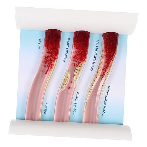 KICHOUSE Gefäßmodell Lehrmodell Aus Kunststoff Dynamisches Anatomisches Modell Unterrichtsmodell Dynamisches Modell Unterrichten Plastisches Anatomisches Modell Die Hüften von KICHOUSE