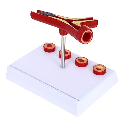 Kichvoe Atherosklerose Anatomisches Modell für Material Realistisches Lehrmittel für Studenten Ärzte für Medizinische Ausbildung Kichvoe Atherosklerose Anatomisches Modell für Material Realistisches Lehrmittel für Studenten Ärzte für Medizinische Ausbildung von Kichvoe