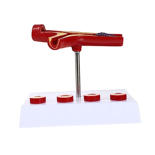 Atherosklerose Anatomisches Modell Realistisches Gefäßmodell für Medizinische Ausbildung Demonstration zur Veranschaulichung von von LAPYAPPE