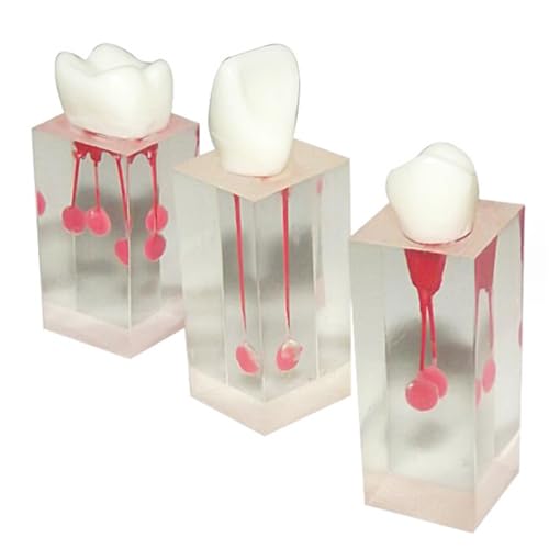 3 Pcs Zähne Lehrmodell Dental Partikel Gefärbt Rot Pulp Kammer Modell Krone Pulp Modelle für Lehre und Studium (rot) von LKYLVEE