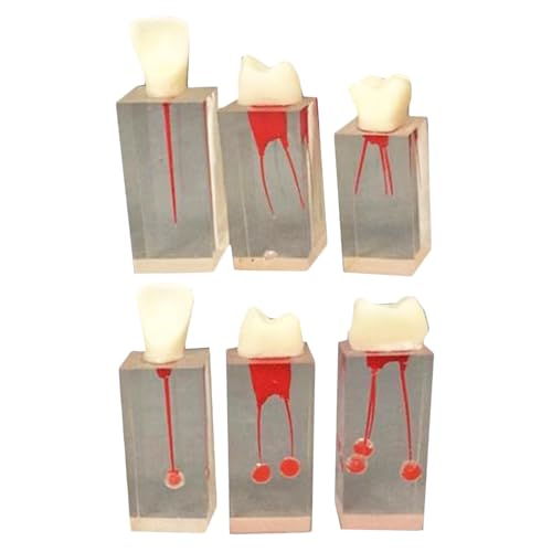 6 Stück Endodontische Transparent Wurzelkanal Modell Dental Harz Wurzelkanal Übung Block Modell für Lehre und Studium von LKYLVEE