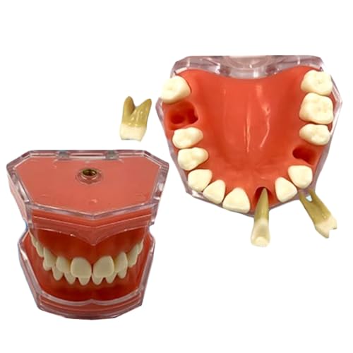 LKYLVEE Dental Erwachsene Demonstration Zähne Modell, Erwachsene Standard Dental Mund Modell mit 28 abnehmbaren Zähnen, für Mundpflege Lehren Lernen Werkzeug von LKYLVEE