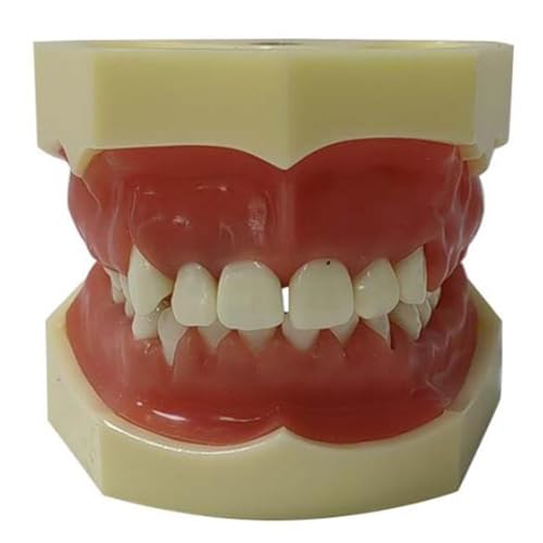 Gingivitis Parodontales Modell - Typhoon Zähne Modell - Dental Teaching Model Resin Teeth Model with Tartar Gingival Hard Periodontal Model (A) von LKYLVEE