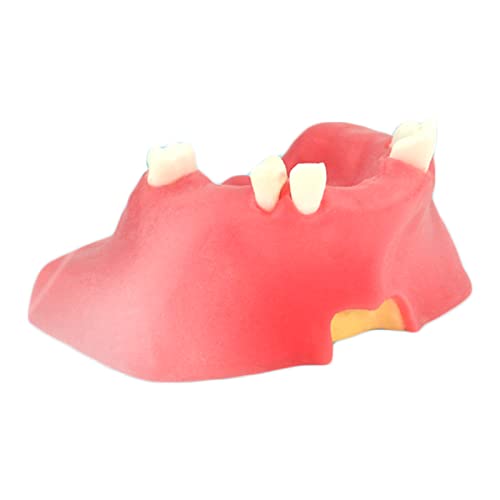 Kiefer-Zahnimplantat-Modell, Simulationsmodell der Kieferhöhlenlift-Implantatpraxis – Studienmodell für Erwachsene Zahnmodell für Erwachsene von LKYLVEE