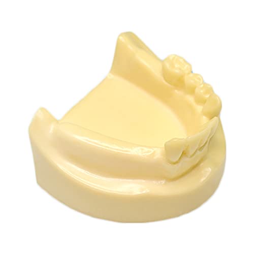 Mandibulär-Implantatmodell – Orales Implantat-Praxis Zahnmodell – Zahnmodell für die Bildung – Andibuläre Overdenture Implantat Zahnmodell – für Studienunterricht von LKYLVEE