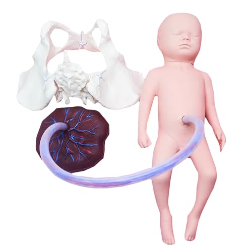 Neugeborenes Baby Modell mit Nabelschnur und Plazenta - Hebammen-Trainingsmodell - mit Frontanelle und hinterer Fontanelle (Junge) von LKYLVEE