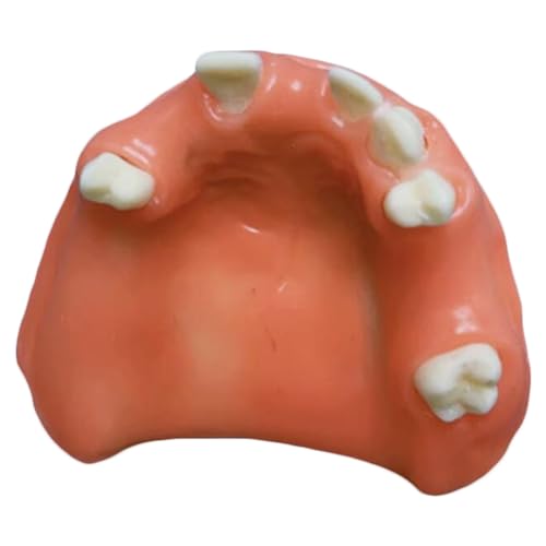 Oral Implantat Praxis Modell, Kieferhöhle Lift Modell, Zahnextraktion Trainingsmodell für Studium Lehre Display von LKYLVEE
