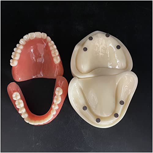 Pädagogisches Modell Zahnimplantate Modell – Vollmund-Adsorptions-Zahnprothesenmodell mit 4 Implantaten – Medizinisches Zahnlehrmodell – für Schulausbildung von LKYLVEE