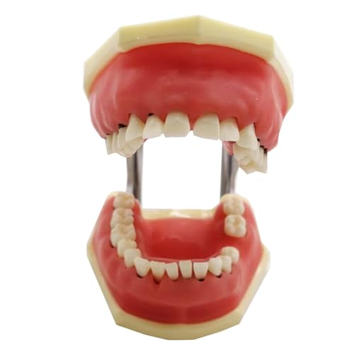 Transparentes Zahnstudienmodell für Parodontopathie, Parodontalerkrankungen, Zahnarztpraxis, Zahnschaben, Zahnsteinmodell (rot) von LKYLVEE