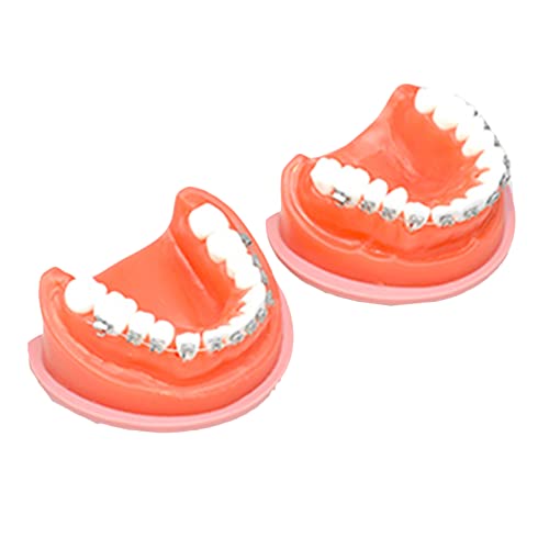 Typhoon Zahnmodell – pädagogisches Modell für kieferorthopädische Zähne – simuliertes Oralzahn-Lehrmodell – für Wissenschaftsunterricht, Forschungsdisplay, Laborbedarf (A) von LKYLVEE
