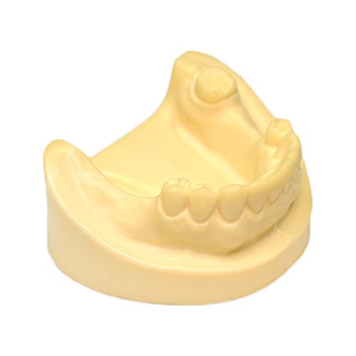 Zahnimplantat-Modell – Simuliertes Mundzahnmodell Implantat Mandibular fehlendes Implantat Praxis Übung Silikon Nahtmodell – für Unterricht Studie Anzeige von LKYLVEE