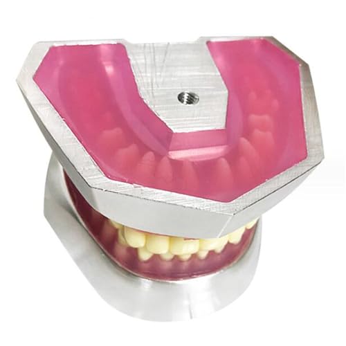 Zahnimplantat Trainingsmodell Oral Implantat Zähne Modell 32 Zähne Harz-Extraktion Modell für Studium Lehre von LKYLVEE