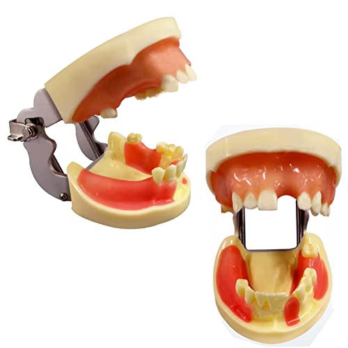 Zahnimplantatmodell – Lehrmodell für Zahnärzte – Simulation der Harz-Zahnarztunterrichtsform – Vollmaul abnehmbar – für wissenschaftlichen Unterricht von LKYLVEE