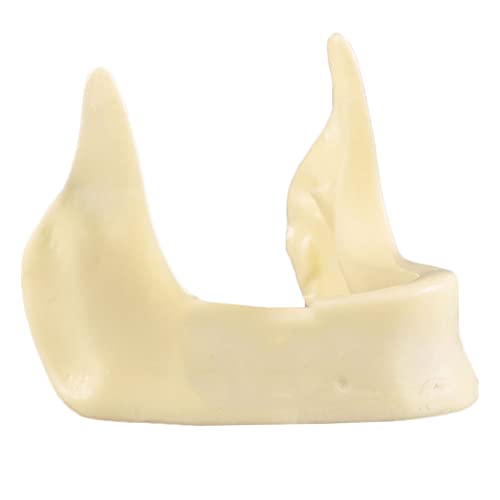 Zahnmodell für Unterkieferimplantate – Das Simulationsmodell der Unterkieferimplantatpraxis – Nachahmung von Knochenfüllung, Mundpflegemodell – Studienmodell Zahnlehrmodell (weiß) von LKYLVEE