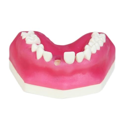 Zahnwurzelkanal Pratice Modell Zähne Wurzel Apex Läsion Modell Verbundharz Faserkern Restaurierungsmodell mit Basis für Vorderzähne von LKYLVEE