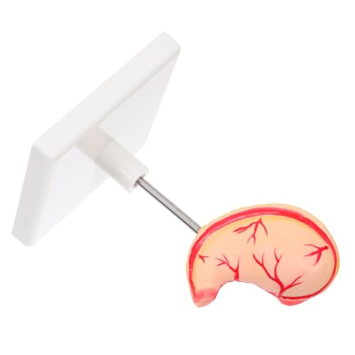 LOLIPPYY Stabiles Magenmodell für Anatomieunterricht Medizinisches Lehrmodell mit Präziser Darstellung Langlebiges Stomach Teaching Aid für und Klinische Ausbildung LOLIPPYY Stabiles Magenmodell für Anatomieunterricht Medizinisches Lehrmodell mit Präziser Darstellung Langlebiges Stomach Teaching Aid für und Klinische Ausbildung von LOLIPPYY