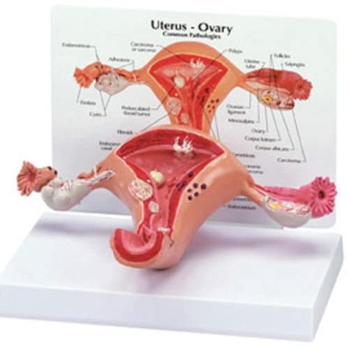 LSOAARRT Anatomisches Modell, anatomische Form, Uterus, Uterus, Anatomie, Querschnitt, Studie von LSOAARRT