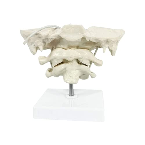 LSOAARRT Menschliche Halswirbelsäule Modell Okzipital Knochen Modell PVC Material Atlas und Achse mit Okzipitalem Knochenmodell für medizinische Lehr von LSOAARRT