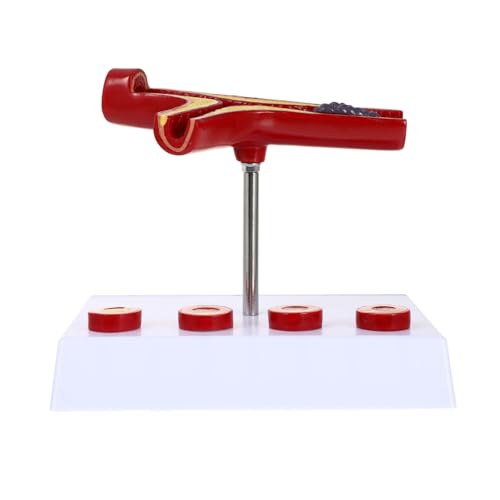 Luxshiny Anatomisches Modell aus Lehrmittel zur für und Medizinische Ausbildung Zeigt Blutgefäße Thrombose und Arterielle Stenose Verschiedenen Krankheitsstadien Hochwertige Langlebige Luxshiny Anatomisches Modell aus Lehrmittel zur für und Medizinische Ausbildung Zeigt Blutgefäße Thrombose und Arterielle Stenose Verschiedenen Krankheitsstadien Hochwertige Langlebige von Luxshiny